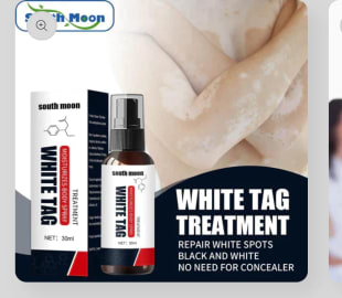 White Spot Reduce Spray White Tag Vitiligo Treatment Moisturizing Skin Spray( Pack Of 2)